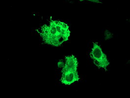Anti-FBXO31 mouse monoclonal antibody immunofluorescent staining of COS7 cells transiently transfected by pCMV6-ENTRY FBXO31.