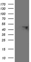 HEK293T cells were transfected with the pCMV6-ENTRY control (Left lane) or pCMV6-ENTRY FBXO31 (Right lane) cDNA for 48 hrs and lysed. Equivalent amounts of cell lysates (5 ug per lane) were separated by SDS-PAGE and immunoblotted with anti-FBXO31.