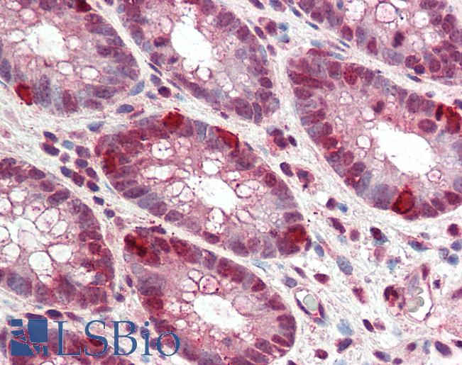 Anti-FBXO31 antibody IHC staining of human colon. Immunohistochemistry of formalin-fixed, paraffin-embedded tissue after heat-induced antigen retrieval. Antibody LS-B10302 concentration 5 ug/ml.