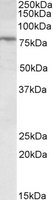 FBXO31 antibody (0.3 ug/ml) staining of KELLY lysate (35 ug protein in RIPA buffer). Primary incubation was 1 hour. Detected by chemiluminescence.
