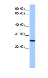 Fetal liver lysate. Antibody concentration: 1.0 ug/ml. Gel concentration: 12%.