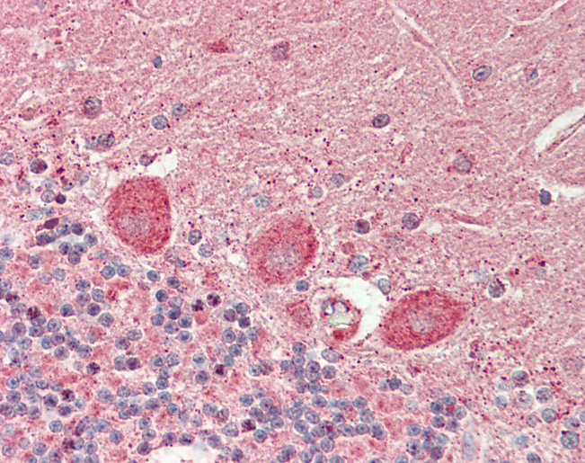 Human Brain, Cerebellum: Formalin-Fixed, Paraffin-Embedded (FFPE)