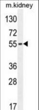 FBXO39 Antibody western blot of mouse kidney tissue lysates (35 ug/lane). The FBXO39 antibody detected the FBXO39 protein (arrow).