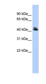 FBXO4 antibody LS-C102003 Western blot of 293T cell lysate.