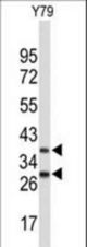 Western blot of FBXO4 Antibody in Y79 cell line lysates (35 ug/lane). FBXO4 (arrow) was detected using the purified antibody.