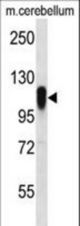 FBX41 Antibody western blot of mouse cerebellum tissue lysates (35 ug/lane). The FBX41 antibody detected the FBX41 protein (arrow).