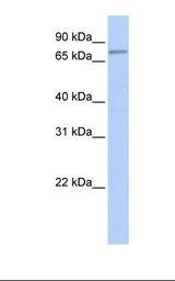 Fetal brain lysate. Antibody concentration: 1.0 ug/ml. Gel concentration: 12%.
