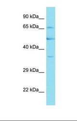 Western blot of HepG2. FBXO46 antibody dilution 1.0 ug/ml.