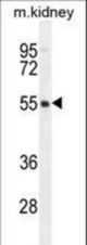 FBXO47 Antibody western blot of mouse kidney tissue lysates (35 ug/lane). The FBXO47 antibody detected the FBXO47 protein (arrow).