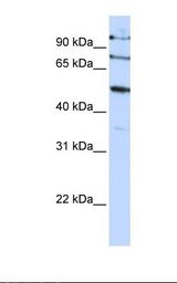 HepG2 cell lysate. Antibody concentration: 1.0 ug/ml. Gel concentration: 12%.