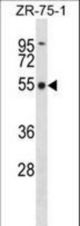 FBXO5 Antibody western blot of ZR-75-1 cell line lysates (35 ug/lane). The FBXO5 antibody detected the FBXO5 protein (arrow).