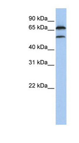 FBXO7 antibody LS-C102004 Western blot of MCF7 cell lysate.