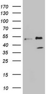 HEK293T cells were transfected with the pCMV6-ENTRY control (Left lane) or pCMV6-ENTRY FBXO8 (Right lane) cDNA for 48 hrs and lysed. Equivalent amounts of cell lysates (5 ug per lane) were separated by SDS-PAGE and immunoblotted with anti-FBXO8 (1:2000).