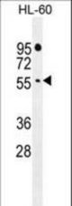 FBXW11 Antibody western blot of HL-60 cell line lysates (35 ug/lane). The FBXW11 antibody detected the FBXW11 protein (arrow).