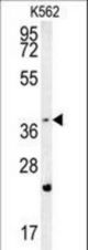 FBXW12 Antibody western blot of K562 cell line lysates (35 ug/lane). The FBXW12 antibody detected the FBXW12 protein (arrow).