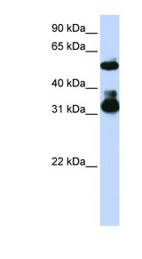 FBXW2 antibody LS-C102000 Western blot of Jurkat lysate.