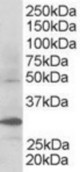 Antibody staining (0.3 ug/ml) of Human Kidney lysate (RIPA buffer, 30 ug total protein per lane). Primary incubated for 1 hour. Detected by Western blot of chemiluminescence.