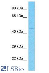 FBXW5 antibody Western Blot of MDA-MB-435S. Antibody dilution: 1 ug/ml.