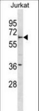 FBXW5 Antibody western blot of Jurkat cell line lysates (35 ug/lane). The FBXW5 antibody detected the FBXW5 protein (arrow).
