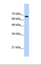 Jurkat cell lysate. Antibody concentration: 0.25 ug/ml. Gel concentration: 12%.
