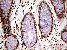 IHC of paraffin-embedded Human colon tissue using anti-FBXW7 mouse monoclonal antibody. (Heat-induced epitope retrieval by 10mM citric buffer, pH6.0, 120°C for 3min).