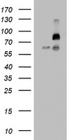 HEK293T cells were transfected with the pCMV6-ENTRY control (Left lane) or pCMV6-ENTRY FBXW7 (Right lane) cDNA for 48 hrs and lysed. Equivalent amounts of cell lysates (5 ug per lane) were separated by SDS-PAGE and immunoblotted with anti-FBXW7.