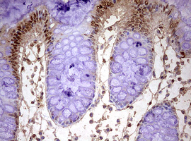 IHC of paraffin-embedded Human colon tissue using anti-FBXW7 mouse monoclonal antibody. (Heat-induced epitope retrieval by 10mM citric buffer, pH6.0, 120°C for 3min).