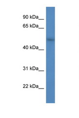 FBXW9 antibody LS-C135794 Western blot of HepG2 Cell lysate. Antibody concentration 1 ug/ml.