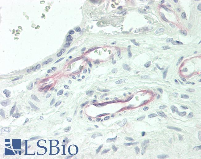 Human Placenta: Formalin-Fixed, Paraffin-Embedded (FFPE)