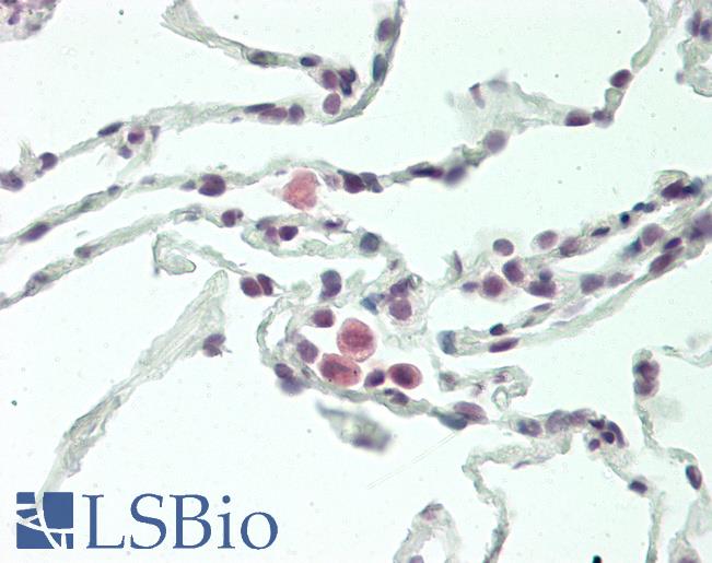 Human Lung: Formalin-Fixed, Paraffin-Embedded (FFPE)