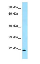 FCAR / CD89 antibody Western Blot of Placenta.