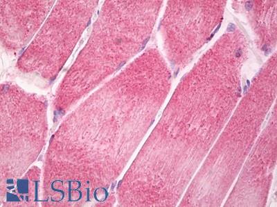 Anti-CNTFR antibody IHC of human skeletal muscle. Immunohistochemistry of formalin-fixed, paraffin-embedded tissue after heat-induced antigen retrieval. Antibody LS-B8254 dilution 5-10 ug/ml.