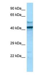 FCGR1A / CD64 antibody Western Blot of NCI-H226.