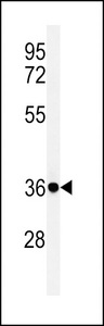 Western blot of FCGR1A Antibody in NCI-H460 cell line lysates (35 ug/lane). FCGR1A (arrow) was detected using the purified antibody.