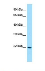 Western blot of Human Hela. FCGR1B antibody dilution 1.0 ug/ml.