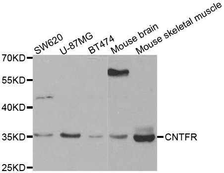Western blot analysis of extracts of various cell lines, using CNTFR antibody.