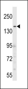 CNTLN Antibody western blot of HL-60 cell line lysates (35 ug/lane). The CNTLN antibody detected the CNTLN protein (arrow).