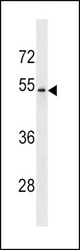 FCGRT Antibody western blot of NCI-H460 cell line lysates (35 ug/lane). The FCGRT antibody detected the FCGRT protein (arrow).
