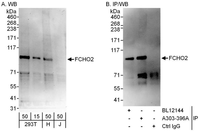 Detection of Human FCHO2 by Western Blot and Immunoprecipitation. Samples: Whole cell lysate from 293T (15 and 50 ug for WB; 1 mg for IP, 20% of IP loaded), HeLa (H; 50 ug) and Jurkat (J; 50 ug) cells. Antibodies: Affinity purified rabbit anti-FCHO2 antibody used for WB at 0.04 ug/ml (A) and 0.4 ug/ml (B) and used for IP at 6 ug/mg lysate. FCHO2 was also immunoprecipitated by rabbit anti-FCHO2 antibody BL12144, which recognizes an upstream epitope. Detection: Chemiluminescence with exposure times of 60 seconds (A) and 10 seconds (B).