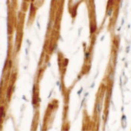 Immunohistochemistry of FCHO2 in human heart tissue with FCHO2 antibody at 2.5 ug/ml.