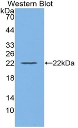 Western blot of recombinant FCN2 / Ficolin-2.
