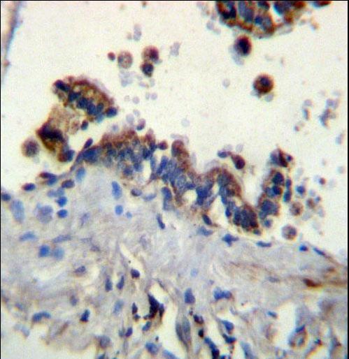 FCN3 Antibody immunohistochemistry of formalin-fixed and paraffin-embedded human lung tissue followed by peroxidase-conjugated secondary antibody and DAB staining.