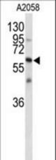Western blot of CNTN1 Antibody in A2058 cell line lysates (35 ug/lane). CNTN1 (arrow) was detected using the purified antibody.