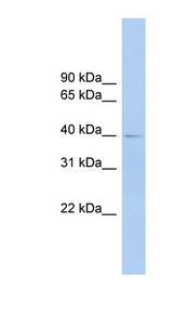 FCRLA antibody LS-C116382 Western blot of Fetal lung lysate.
