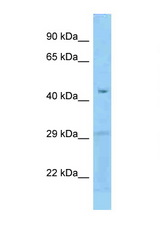 FCRLB antibody LS-C146301 Western blot of Fetal Liver lysate. Antibody concentration 1 ug/ml.