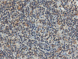 IHC of paraffin-embedded Human lymphoma tissue using anti-FDFT1 mouse monoclonal antibody.