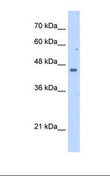 Jurkat cell lysate. Antibody concentration: 2.5 ug/ml. Gel concentration: 12%.