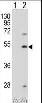 Western blot of FDFT1 (arrow) using rabbit polyclonal FDFT1 Antibody (A155). 293 cell lysates (2 ug/lane) either nontransfected (Lane 1) or transiently transfected (Lane 2) with the FDFT1 gene.
