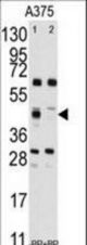 Western blot of anti-FDFT1 Antibody pre-incubated without(lane 1) and with(lane 2) blocking peptide (BP2417b) in A375 cell line lysate. FDFT1(arrow) was detected using the purified antibody.