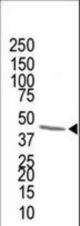 The anti-FDPS antibody is used in Western blot to detect FDPS in human cytokeratin liver cell lysate. Data is kindly provided by Dr. Masaru Harada from Stanford University (Palo Alto, CA).